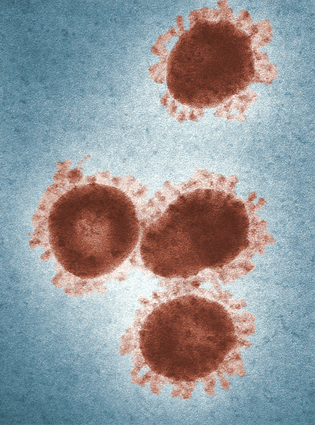 Coronavirus, Wichtigkeit Gebäudereinigung Coronavirus